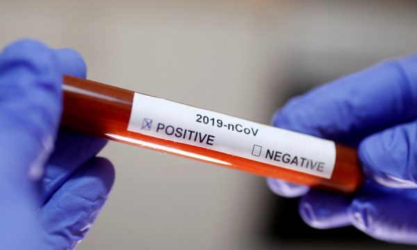 Në Kosovë shkon numri në 28 të prekur nga koronavirusi