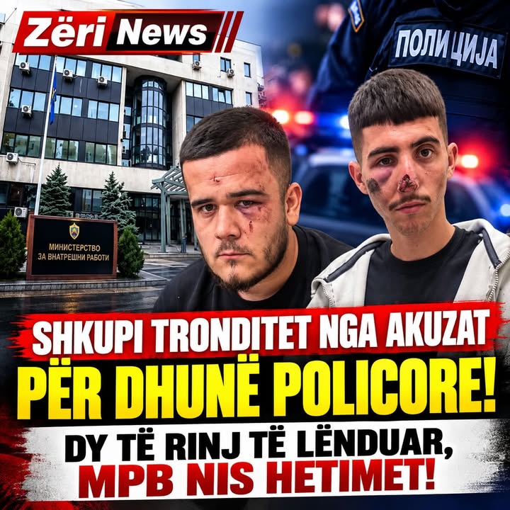 🟥 SHKUPI TRONDITET NGA AKUZAT PËR DHUNË POLICORE – DY TË RINJ TË LËNDUAR, MPB NIS HETIMET!